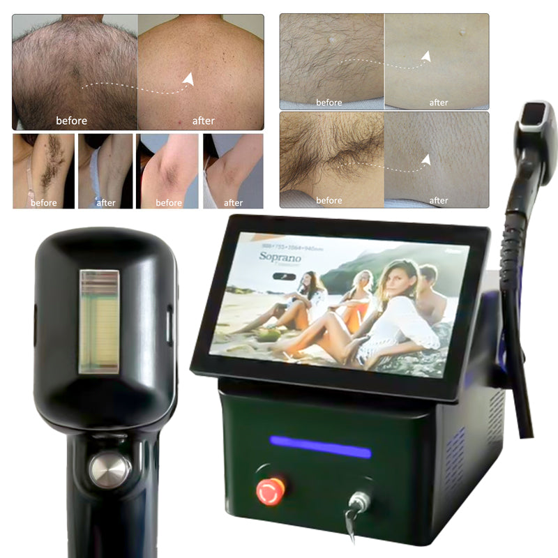 LuminaPulse Diode Laser for Permanent Hair Removal (Desktop Version)