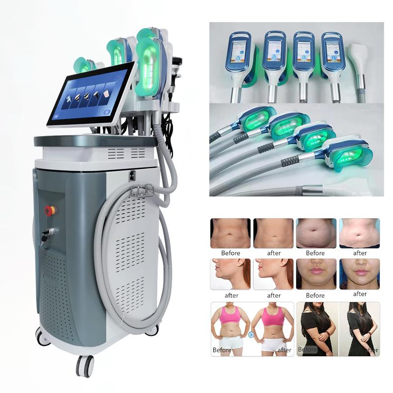 AngelSculp PRO 4 in 1 Cryolipolysis | Cavitation | RF | Lipo Laser Body Contouring Machine