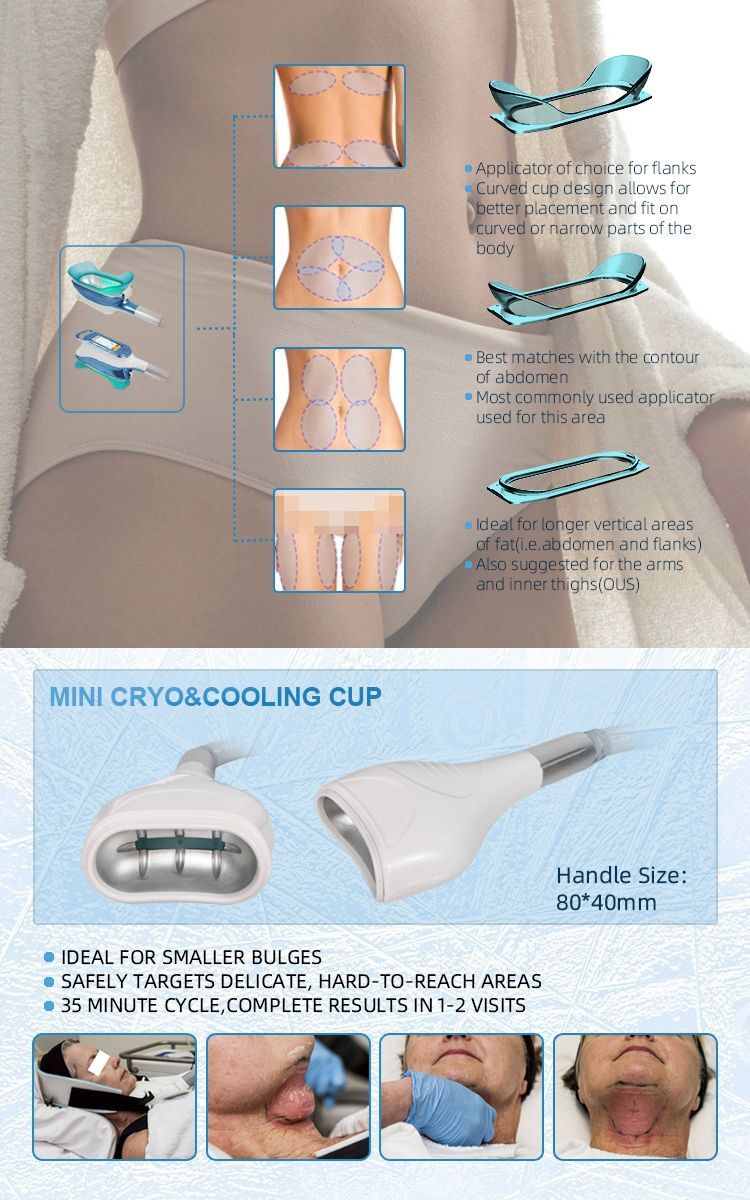 Angel 4 in 1 Cryolipolyse-Machine