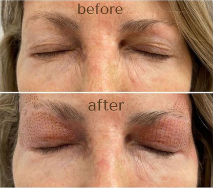 GBS Plasma Glow I