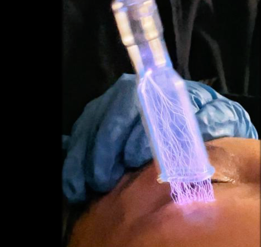 Fusion Plasma Huidverjongingsapparaat
